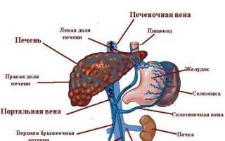 Тромбоз печёночных вен (синдром Бадда-Киари): причины и лечение
