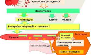 Как и зачем снижать билирубин в организме