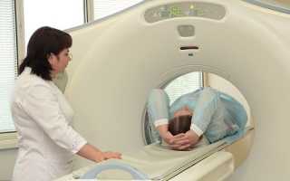 Как проводится МРТ прямой кишки, как подготовиться к процедуре и для чего необходима томография кишечника?