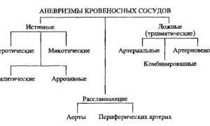 Признаки и лечение аневризмы сосудов головы: важные аспекты