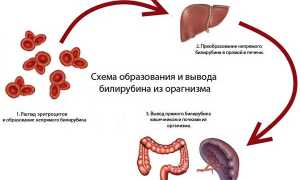 Причины повышения билирубина в крови и способы снижения уровня