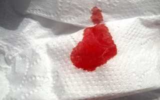 Какие бывают выделения при геморрое?