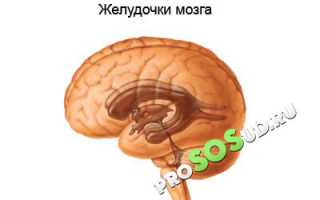 Гидроцефалия головного мозга: описание патологии, причины и лечение для пациентов