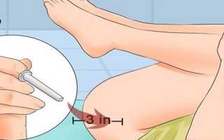 Как сделать клизму ребенку от 1 года в домашних условиях?