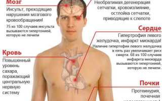 Лечение и классификация гипертонии: важные аспекты и рекомендации