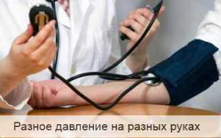 Что означает разное давление на руках и его влияние