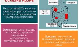 Почему возникает болезнь Крона у ребёнка, как её распознать и можно ли вылечить?