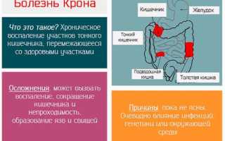 Почему возникает болезнь Крона у ребёнка, как её распознать и можно ли вылечить?