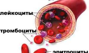 Коагулопатия: причины и лечение заболеваний крови