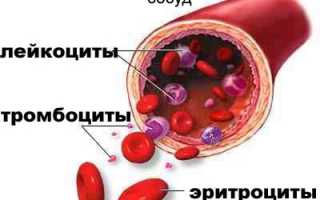 Коагулопатия: причины и лечение заболеваний крови