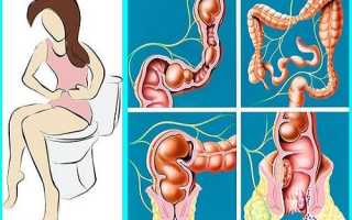 Как избавиться от запора с помощью диеты?