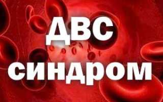 Что такое ДВС-синдром и его последствия