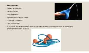 Какова польза клизмы? Рекомендуемая частота проведения процедуры