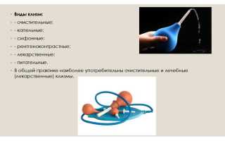Какова польза клизмы? Рекомендуемая частота проведения процедуры