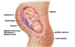 Причины и симптомы геморроя, возникшего при беременности