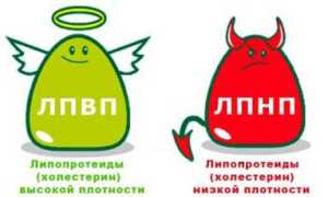Быстрое снижение холестерина без использования лекарств в домашних условиях