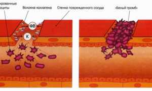 Что такое адгезия тромбоцитов, норма и её значение