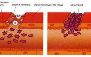 Что такое адгезия тромбоцитов, норма и её значение