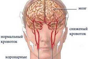 Причины и лечение спазмов сосудов головного мозга: важные аспекты