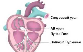 Парасистолия: лечение и диагностика сердечно-сосудистых заболеваний
