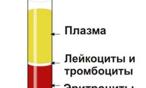 Что такое синдром ускоренного СОЭ и его последствия