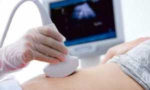 Как проводится УЗИ кишечника, для чего назначается процедура?