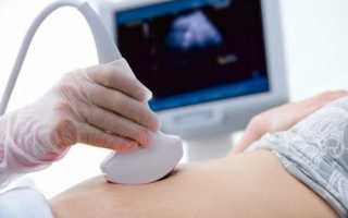 Как проводится УЗИ кишечника, для чего назначается процедура?