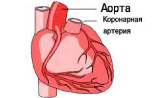 Атеросклеротическая болезнь сердца: причины и последствия
