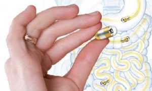 Что такое капсульная эндоскопия, где проводится и сколько стоит процедура?