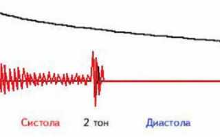 О чем говорят шумы в сердце ребенка: важные аспекты здоровья