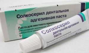 Список популярных в 2019 году препаратов для лечения геморроя и анальной трещины