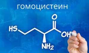 Повышенный гомоцистеин: причины и последствия