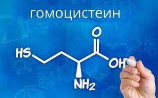 Повышенный гомоцистеин: причины и последствия