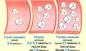 Симптомы гипогликемии и меры помощи при этом состоянии