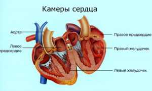 Основные причины атриовентрикулярной блокады сердца, диагностика и лечение заболеваний