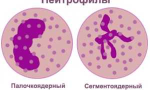 Низкий уровень нейтрофилов в крови у взрослого: причины и последствия