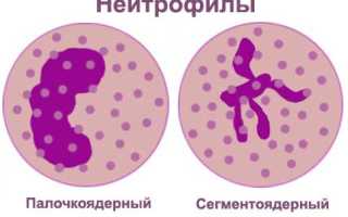 Низкий уровень нейтрофилов в крови у взрослого: причины и последствия