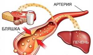 Уровень холестерина при беременности: важные аспекты здоровья