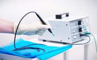 Аппарат Сургитрон для удаления геморроидальных узлов радиоволновым методом