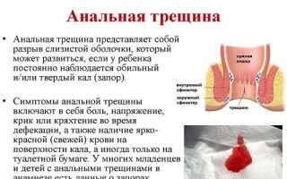 Хирургическое лечение анальной трещины: виды операционных вмешательств