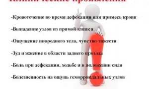 Как проявляется обострение хронической формы геморроя и чем можно помочь?