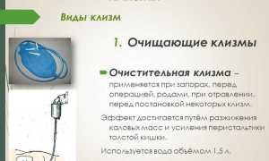 Можно ли поставить клизму при беременности на разных сроках?