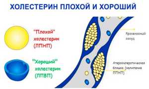 Что такое холестерин ЛПВП и как влияет на здоровье человека