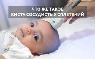 Кисты сосудистых сплетений головного мозга: причины и лечение