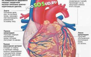 Аортальная недостаточность: лечение, классификация, причины и симптомы