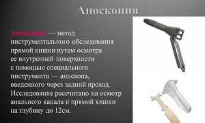 Что такое аноскопия и как проводится процедура?