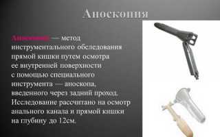 Что такое аноскопия и как проводится процедура?