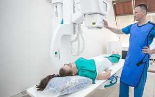 Что такое ирригоскопия кишечника и как к ней приготовиться дома?