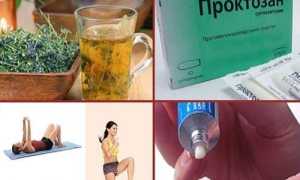 Как быстро вылечить геморрой дома: советы и рекомендации