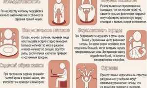 При геморрое болит низ живота, что делать?